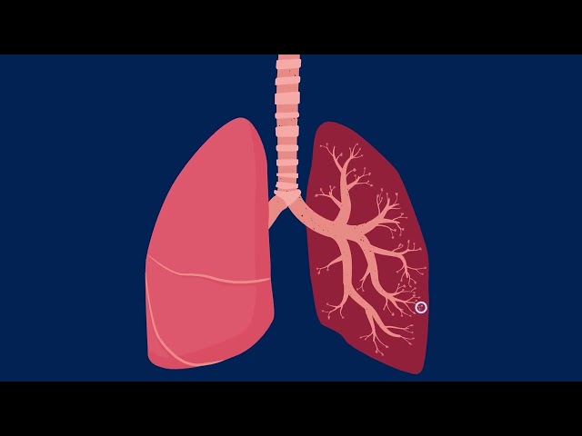 How Particle Pollution Impacts Your Lung