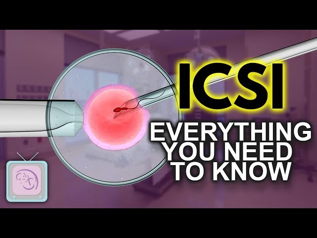 IVF ICSI Procedure - Important things you need to know