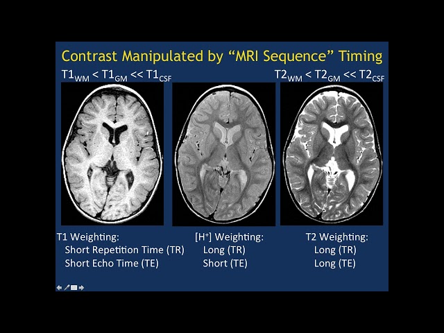MRI Basics Part 1