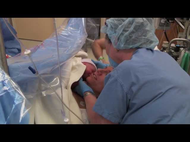 Gentle Cesarean Section Video - Brigham and Women's Hospital