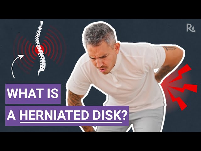 What is a Herniated Disk? Does it Cause Low Back Pain?