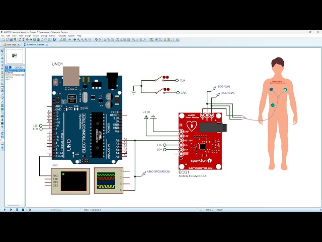 AD8232 Heartrate Monitor Module  |  Proteus Simulation