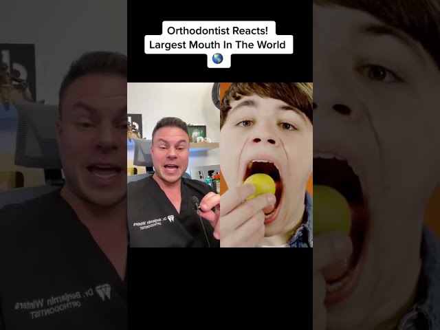 LARGEST MOUTH IN THE WORLD! Orthodontist Reacts! #shorts