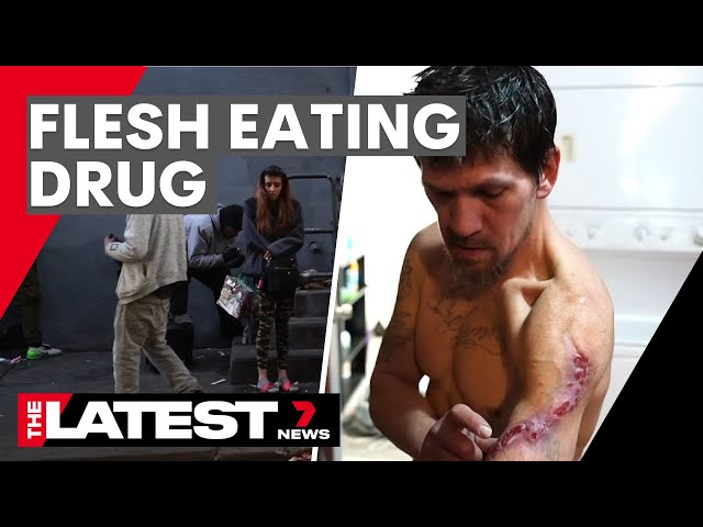 The flesh-eating drug taking over America | 7NEWS