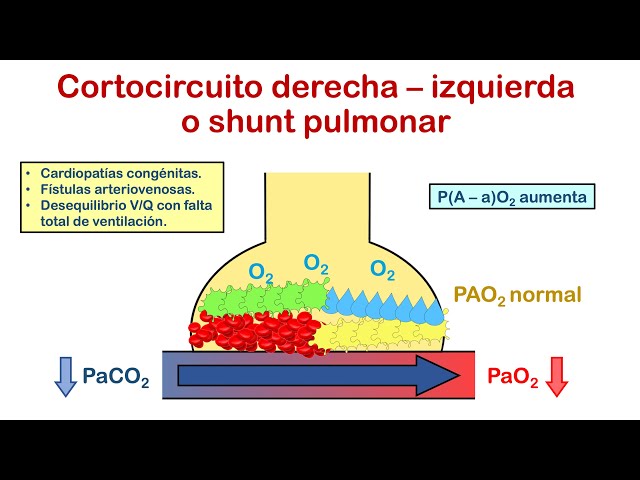 RESPIRATORY FAILURE - Part 1 (Concept, Classification and Pathophysiology) 🤓👍🏻