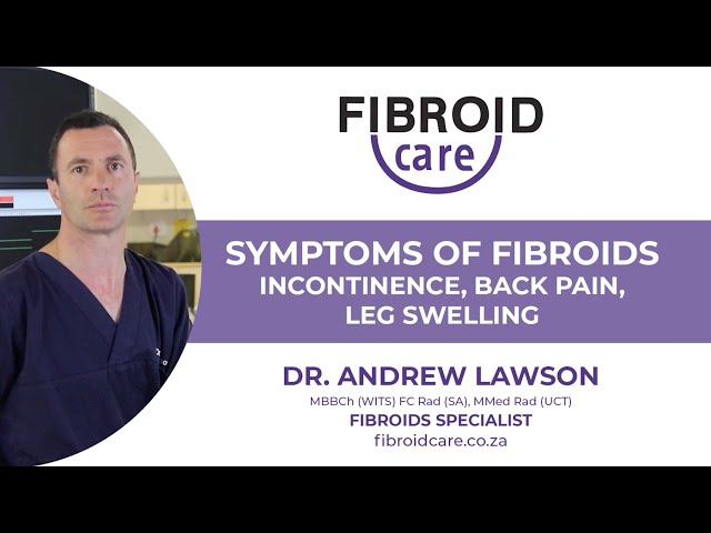 Symptoms of Fibroids: Incontinence, Back Pain, Leg Swelling