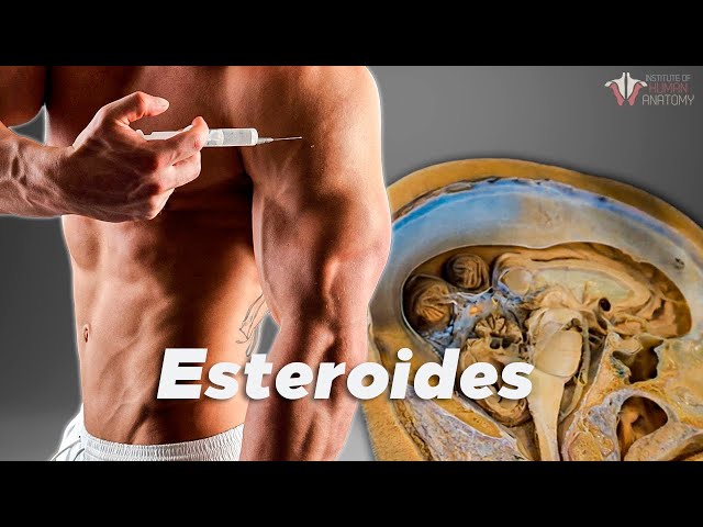 ¿Qué le hacen los esteroides a tu cuerpo?