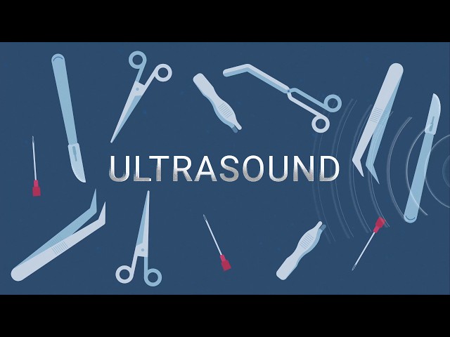 How Does an Ultrasound Work?