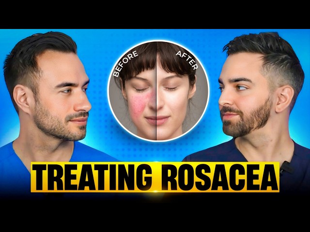 Trata la rosácea como un dermatólogo
