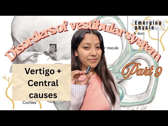 Disorders of vestibular system| Vertigo cental causes | Part 9 | Neurology