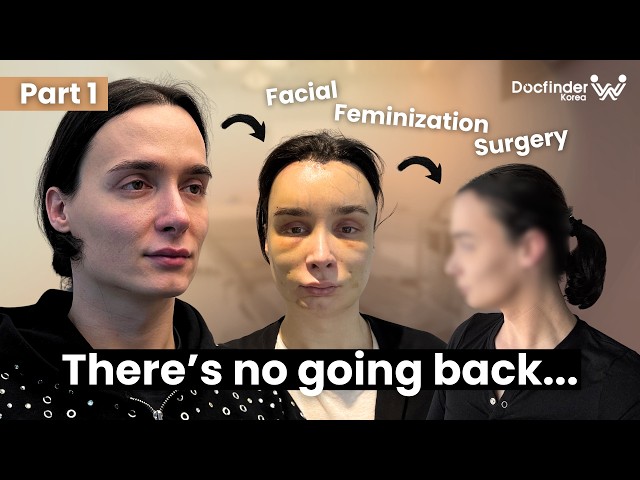 Swiss Woman's FFS Surgery in Korea | Forehead, Jaw & Brow Transformation