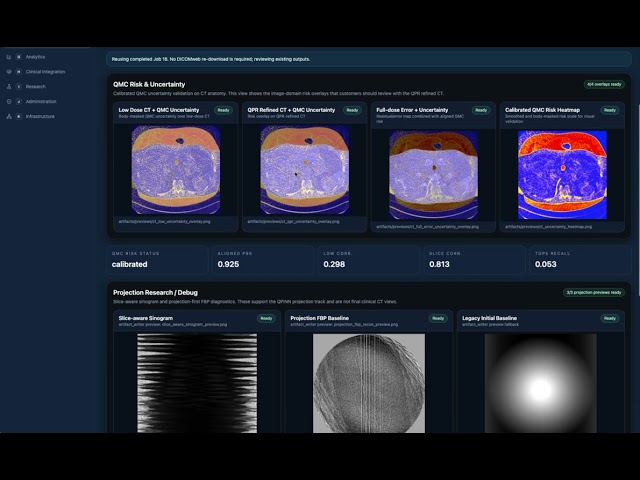 QMedic Medical Image reconstruction with QPINN and QPR