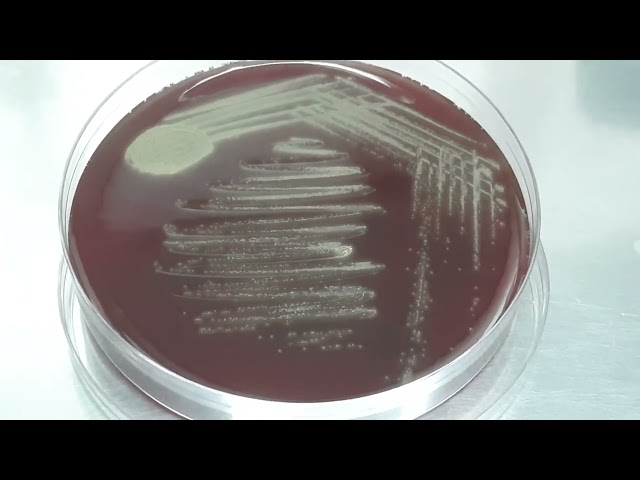 Gemella morbillorum colony Morphology and Gram Staining
