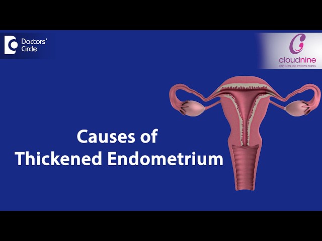 What causes Endometrial thickness? - Dr.Smitha Sha of Cloudnine Hospitals | Doctors' Circle