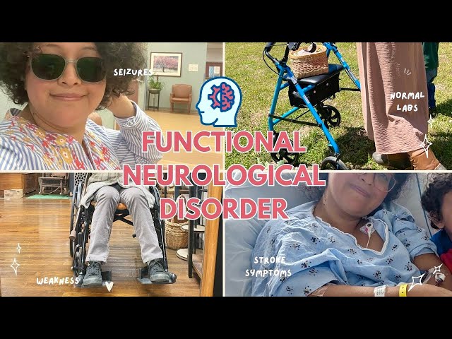 How months of chronic pain turned into stroke symptoms | (FND) Functional neurological disorder