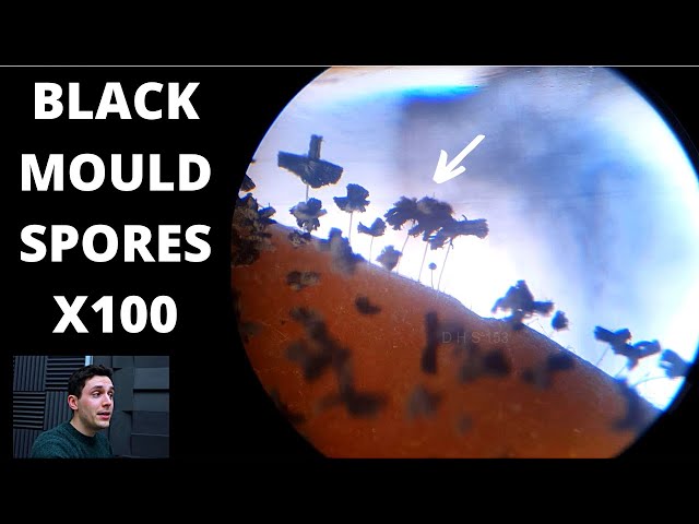 Black Mould Colony UPDATE (Under The Microscope)