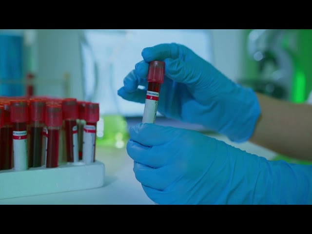 Nanoparticles