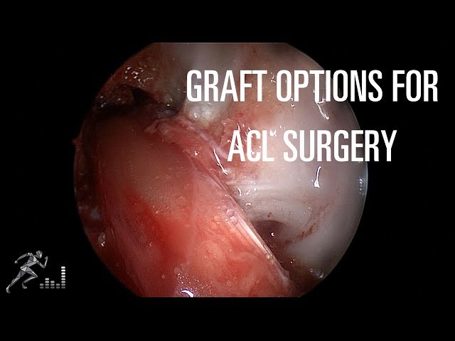 ACL surgery: Graft options