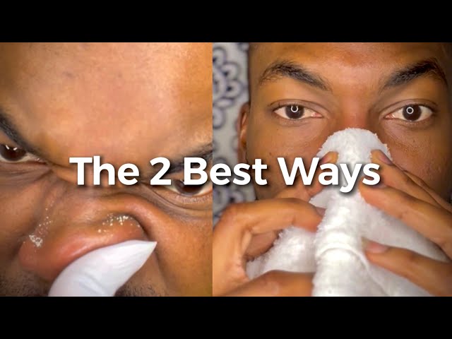 Removing oil in your Nose and Face Tutorial (The 2 best methods in full Details)