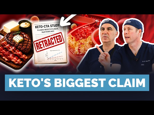 Does Keto Diet Cause High Cholesterol?