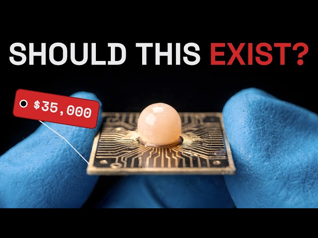 The $35,000 Computer Made From Human Brain Cells