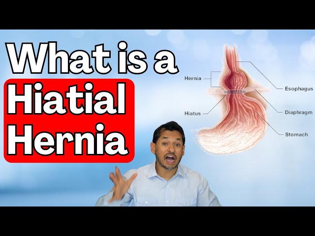What is a Hiatal Hernia | Symptoms and Treatment