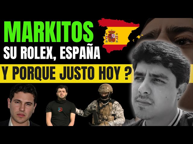Markitos Toys shows off Rolex… but his bitten nails “give him away”