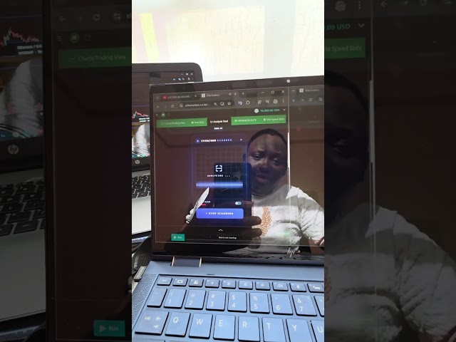 TRADING EVEN MARKET ON DERIV | ELITE TRADERS 