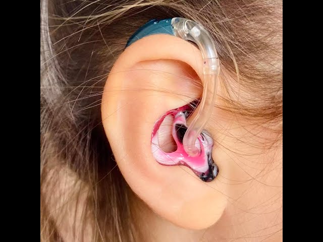 Shocking Truth Revealed: 10 Medical Reason why People Hate Hearing Aids