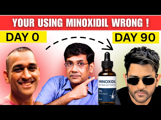 ULTIMATE Step-by-Step MINOXIDIL Usage Guide for Hair Thinning, Male Pattern Baldness & Hair Loss