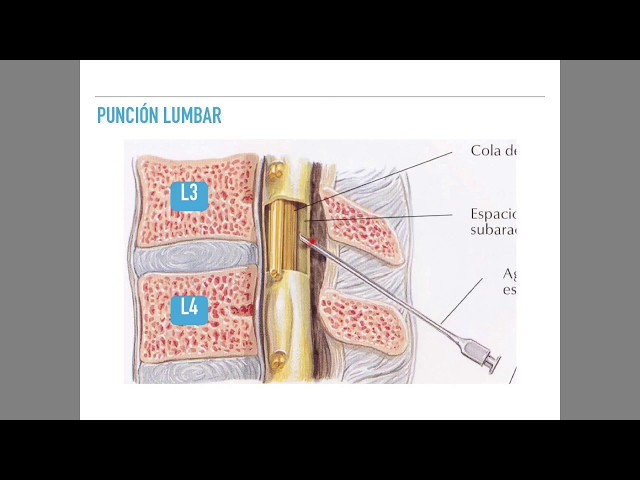 Lumbar puncture and CSF analysis