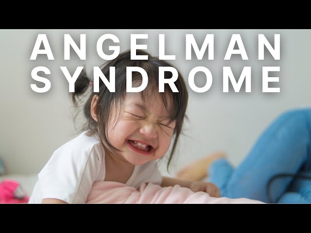 Silent Voices, Bright Smiles: Children with Angelman Syndrome