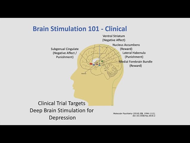 Neuroscience and Brain Stimulation with Dhakshin Ramanathan