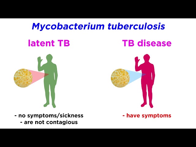 Multidrug-Resistant Tuberculosis (MDR-TB): Mycobacterium tuberculosis