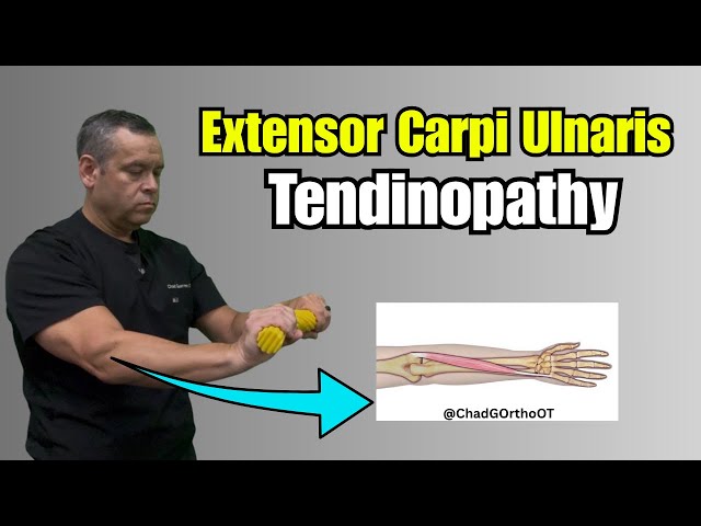 🦴 ECU Tendinopathy Exercises & Wrist Pain Relief (Extensor Carpi Ulnaris) | 5 Therapy Movements