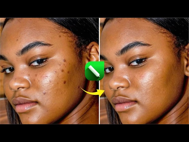 How to Remove Pimples and Dark Spots in CorelDraw PhotoPaint
