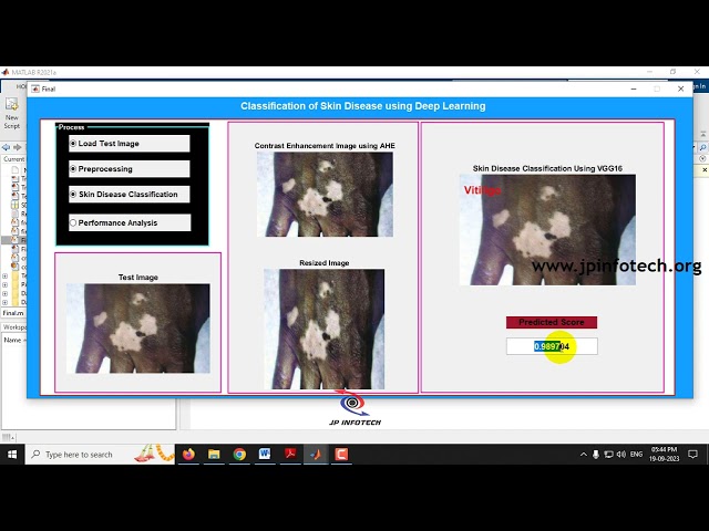 Skin Disease Classification using Deep Learning | MATLAB | Final Year IEEE Project