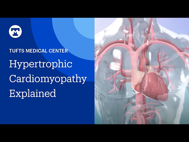 Hypertrophic Cardiomyopathy (HCM) Explained | Tufts Medicine