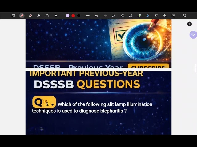 DSSSB TOP 10 OPTOMETRIST / REFRACTIONIST  PREVIOUS YEAR QUESTIONS 