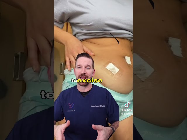 Laparoscopic Endometriosis Surgery Recovery