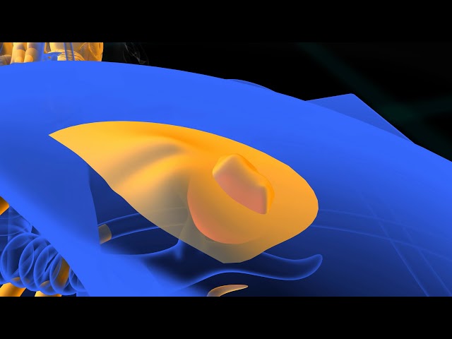 PET Scan animation