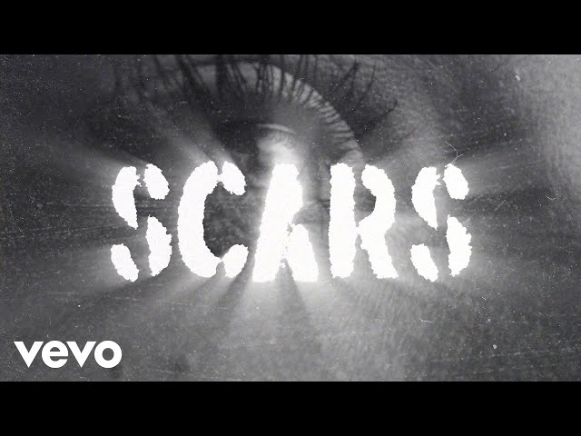 U2 - Scars