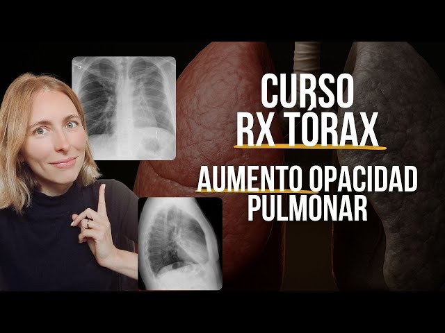 ¿Sabes leer una radiografía de tórax? Empecemos!