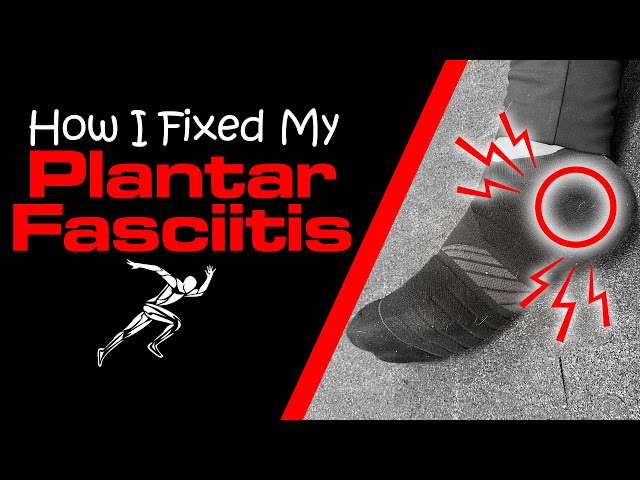 How I Fixed My Plantar Fasciitis