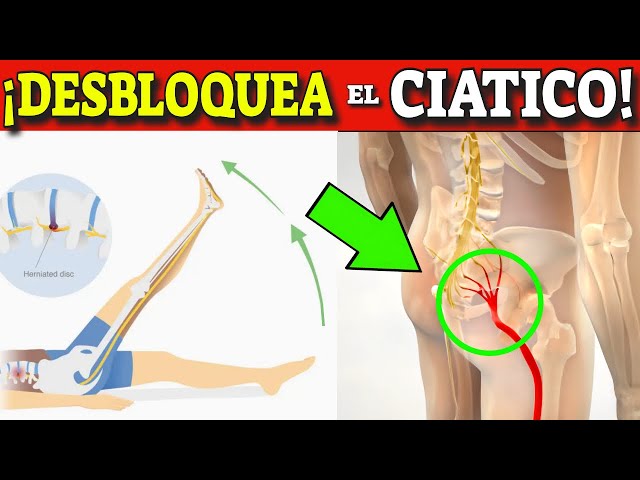 UNLOCKS THE SCIATIC NERVE | What is it and how to cure sciatica?