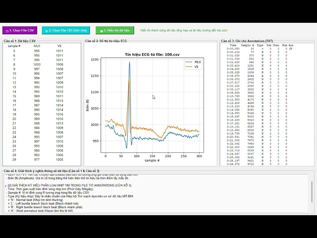Demo MIT BIH ECG Data Viewer with 4 Windows
