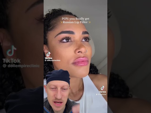 Should You Get Russian Lip Filler? | Plastic Surgeon Reacts