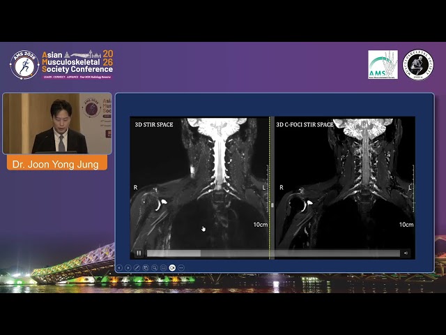 AMS2026 DAY1 HALL C 12 Advanced Neurography Diffusion Tensor Imaging and the Future of Nerve Imaging