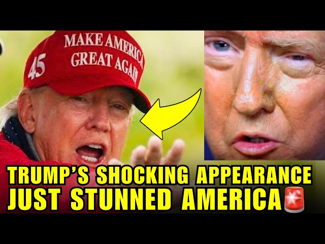 🚨Trump's DEFORMED BODY Just Raised NEW ALARMS About His HEALTH