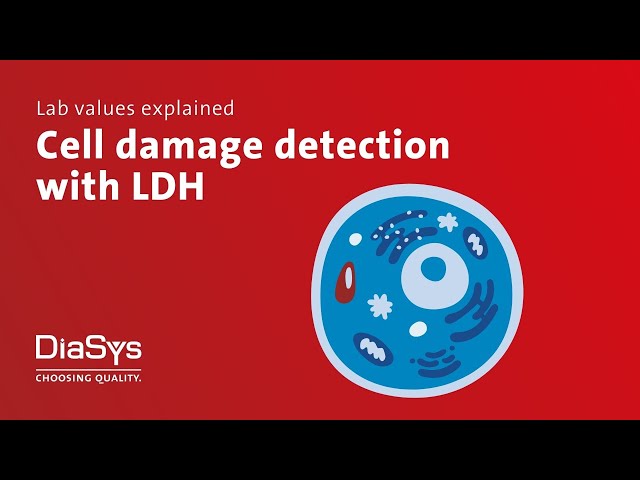 Lab values explained no. 6: LDH